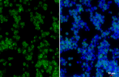 Anti-SHIP1 antibody [HL5204] used in Immunocytochemistry/ Immunofluorescence (ICC/IF). GTX645456